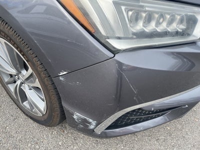 2017 Acura MDX 3.5L SH-AWD w/Technology Package